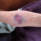 Frank Kosempa - The Effect of Certain Causes: Pain 3.1