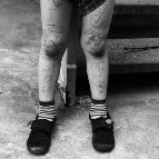 Alex Djordjevic - Child's legs that have been drawn on 