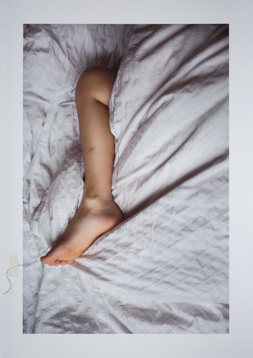 Anne-Laure Autin - Growth [pigment ink print, non dissolvable suture thread]